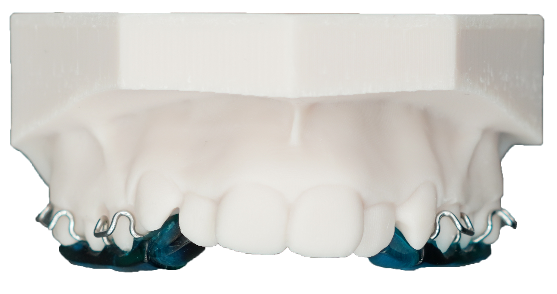 Sagittal Appliance Upper