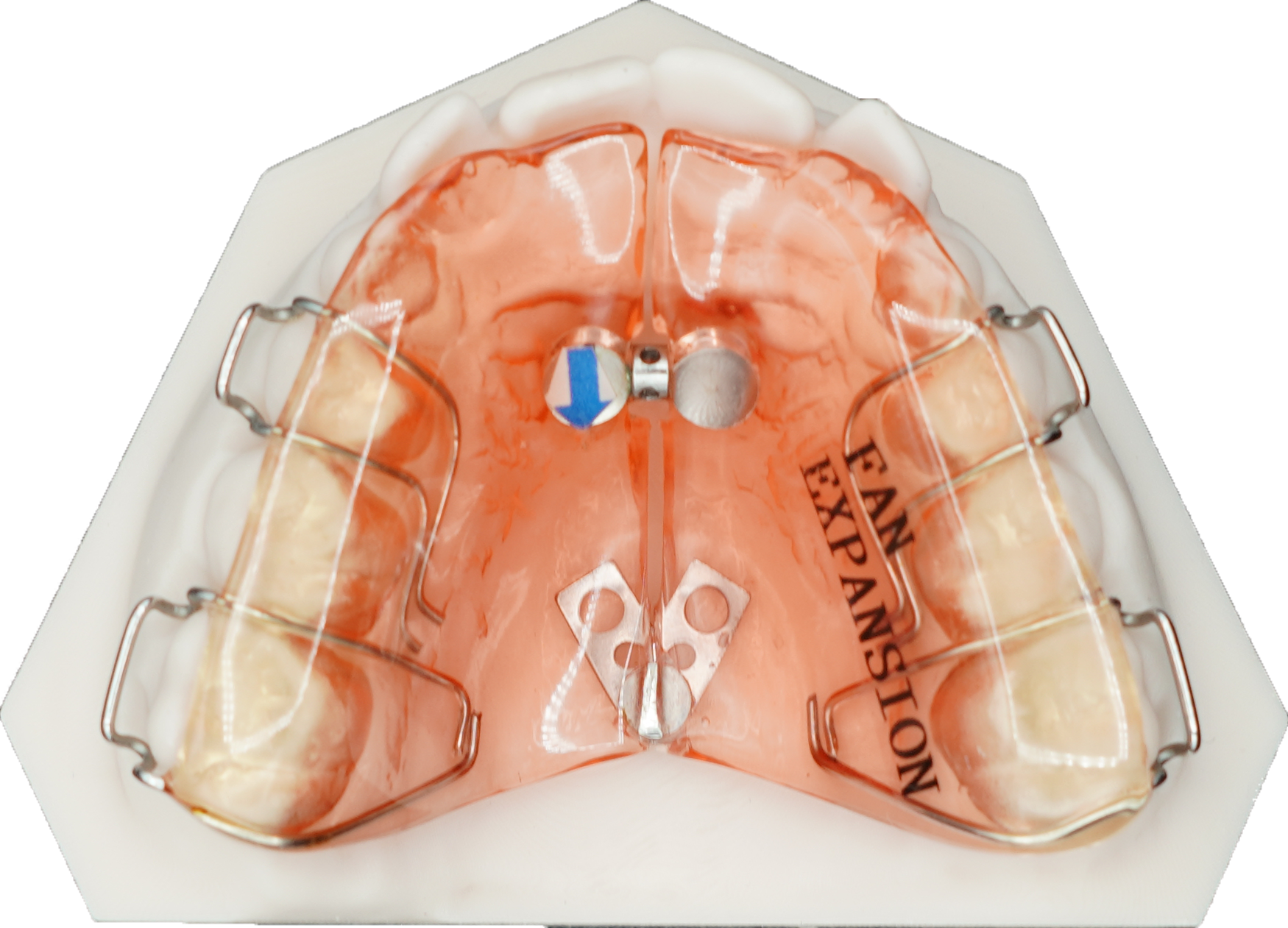 Class III & Sagittals - Fivestar Ortho