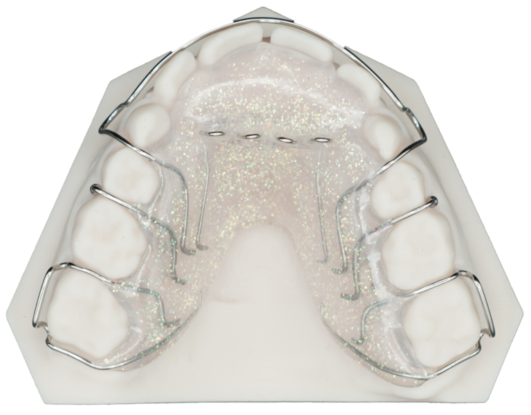 Removable Tongue Thrust Appliance Protec Dental